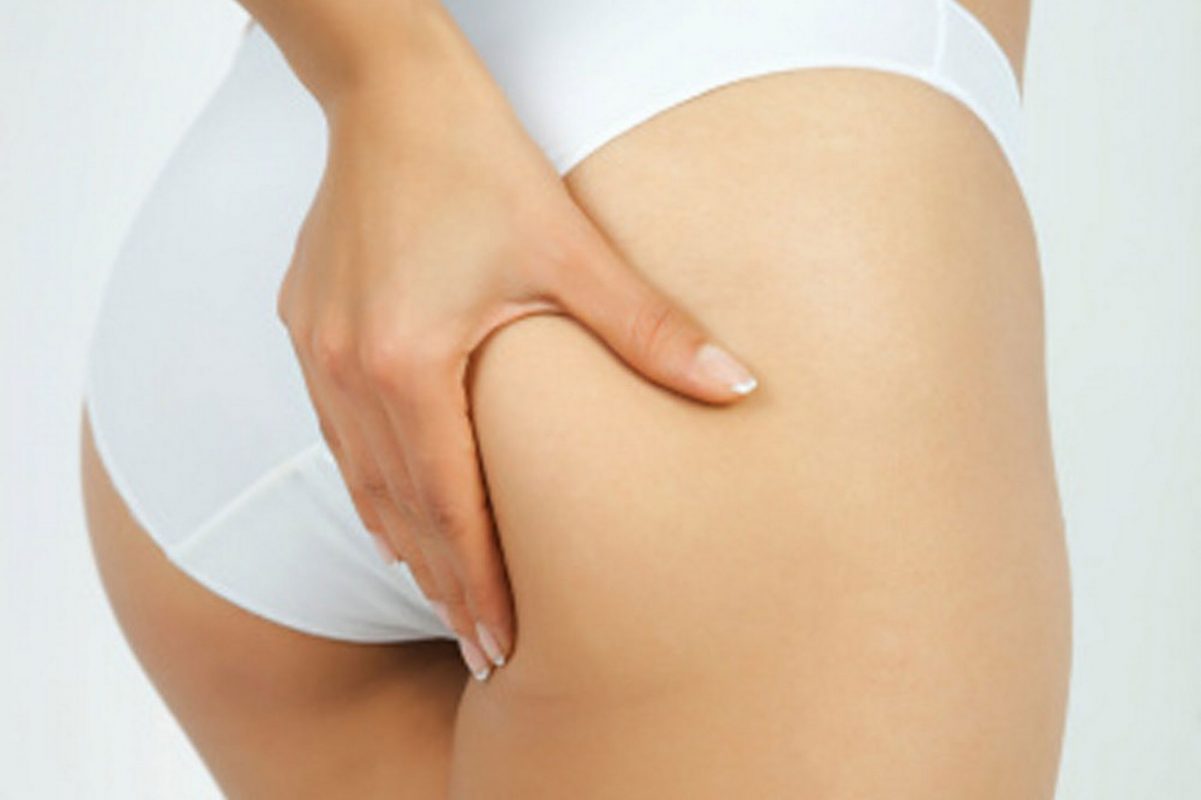 Khắc phục tình trạng mông chảy xệ nhờ chế độ ăn hợp lý